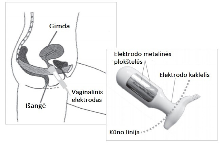 Põie lihaste stimuleerimise seade NeuroTrac CONTINENCE
