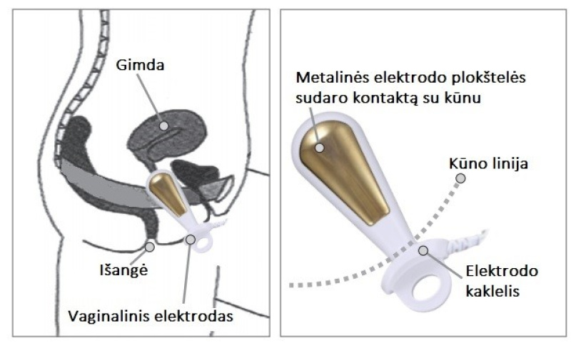 Elektriline stimulaatorist või EMG-stimulatsioonist tingitud vaginaalne elektrood
