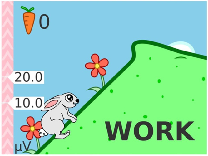 Elektromüograafia seade NeuroTrac MyoPlus Pro EMG (elektristimulatsiooniga)