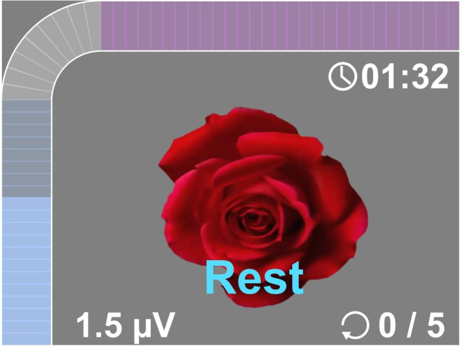Elektromüograafia seade NeuroTrac MyoPlus Pro EMG (elektristimulatsiooniga)