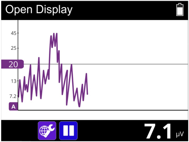 Elektromüograafia seade NeuroTrac MyoPlus Pro EMG (elektristimulatsiooniga)